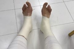 队长担当！媒体人：翟晓川两条腿全拉伤 绑着绷带打了20分钟