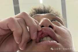 高迪赛后共缝九针:昨天蛮疼今天又是一条好汉,不想错过踢申花